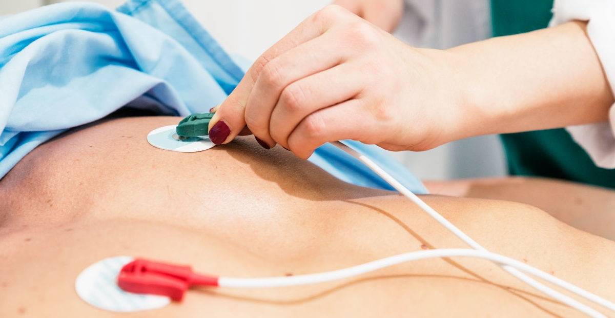 La importancia de colocar los electrodos correctamente