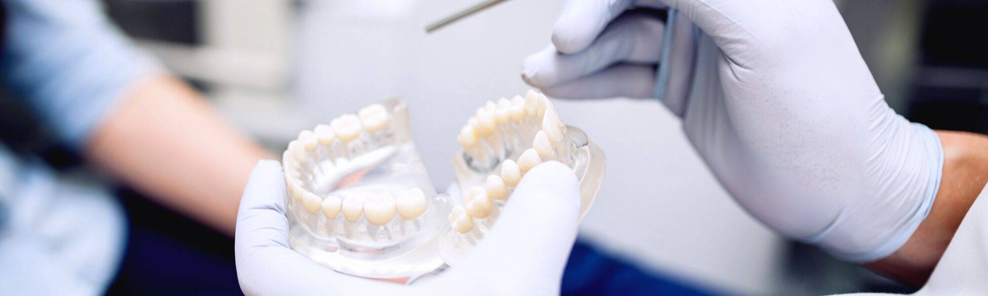 protesico-dental-que-es-y-que-hace-este-profesional