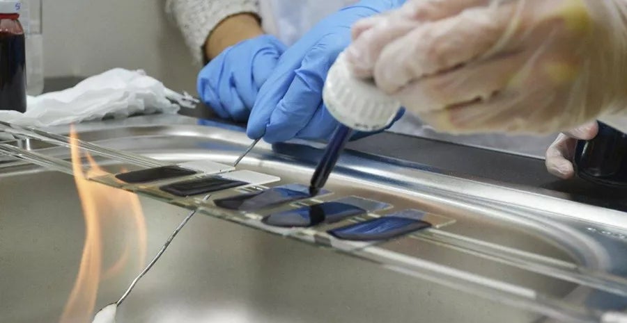 Técnica de tinción de espora bacteriana con verde malaquita en Laboratorio